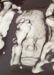 First 4D ultrasound of Bella. She has Eric's button nose! (Week 24)