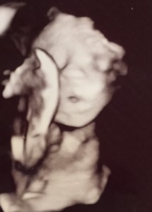 Bella has our mouth open. She is the easiest to see on 4D so she has the most pics. (Week 26)
